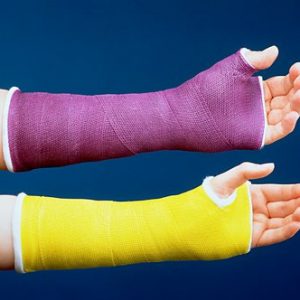 3M™ Scotchcast™ Plus Casting Tape